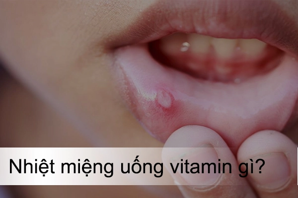 Bị nhiệt miệng nên uống vitamin gì? Cách bổ sung hiệu quả